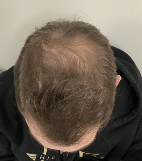 Before